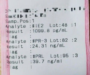 7w6d　採血結果